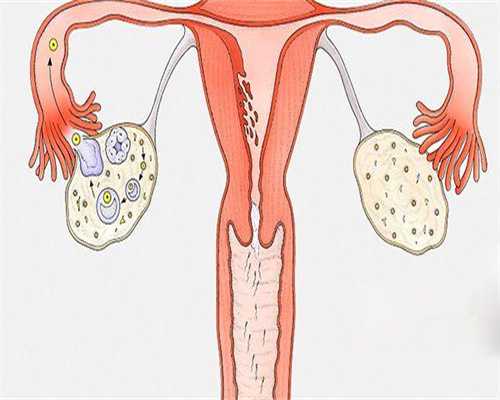 昆明做试管婴儿多少钱呢