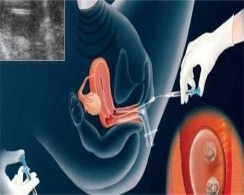 昆明三代试管生宝宝费用一览，三代试管婴儿费用明细？